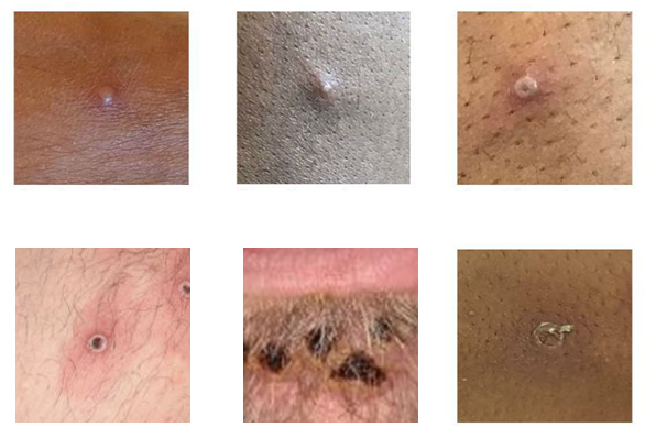 wellcare